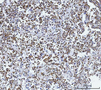 Anti-GLUD1/2 Antibody