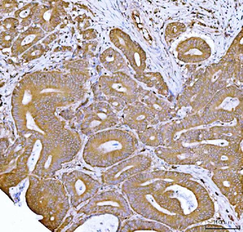 Anti-FKBP1A/1B Antibody