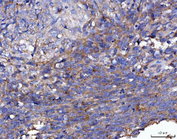 Anti-FGFR2 Antibody
