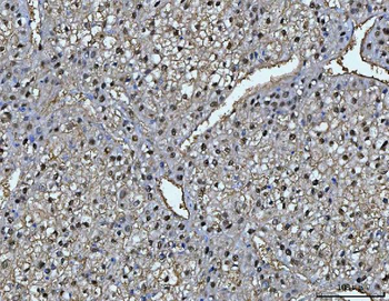 Anti-FAA/FAH Antibody