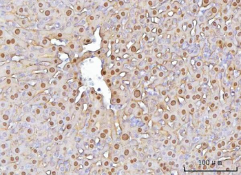 Anti-FAA/FAH Antibody