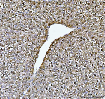Anti-FAA/FAH Antibody