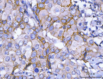 Anti-HER2/ERBB2 Antibody