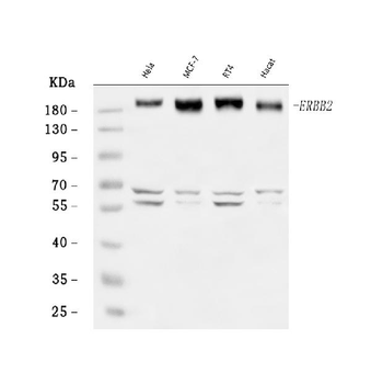 Anti-HER2/ERBB2 Antibody