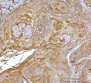 Anti-CRABP2 Antibody