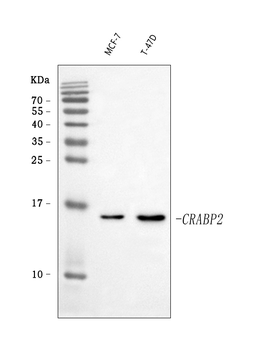Anti-CRABP2 Antibody