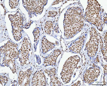 Anti-C1orf77/FOP/CHTOP Antibody
