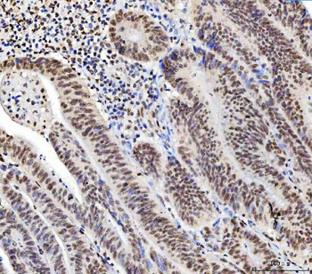 Anti-C1orf77/FOP/CHTOP Antibody