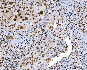 Anti-C1orf77/FOP/CHTOP Antibody