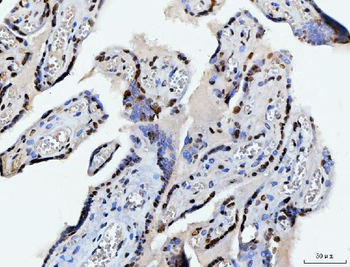 Anti-C1orf77/FOP/CHTOP Antibody