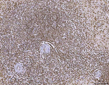 Anti-C1orf77/FOP/CHTOP Antibody