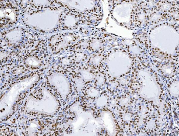 Anti-C1orf77/FOP/CHTOP Antibody