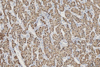 Anti-CES2 Antibody