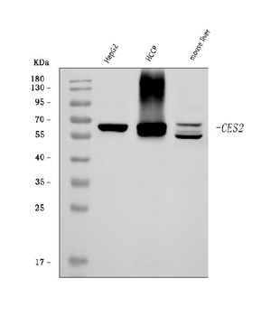 Anti-CES2 Antibody