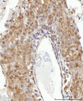 Anti-CEP250 Antibody