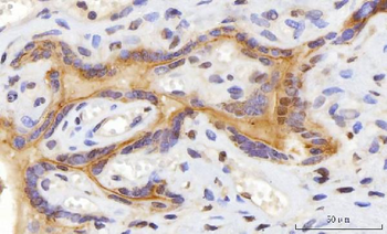Anti-CEP250 Antibody