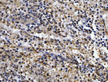 Anti-CEP250 Antibody