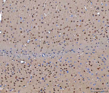 Anti-CEP250 Antibody