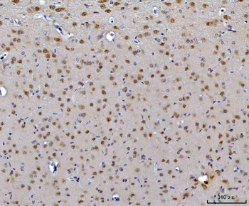 Anti-CEP250 Antibody