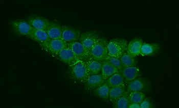 Anti-CCDC115 Antibody