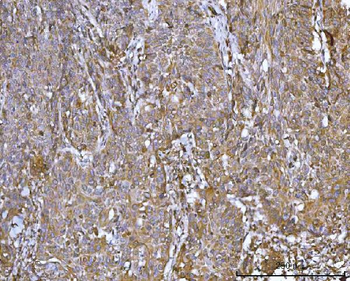 Anti-CCDC115 Antibody