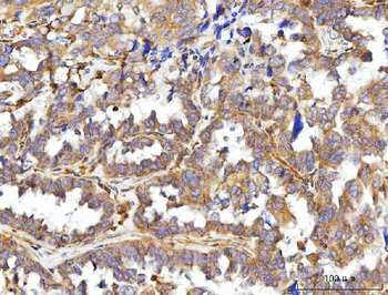 Anti-CCDC115 Antibody