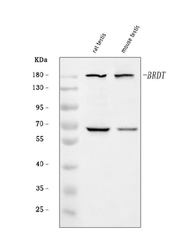 Anti-BRDT Antibody