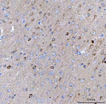Anti-BCAT1 Antibody