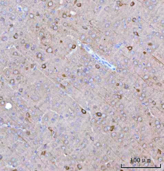 Anti-BCAT1 Antibody