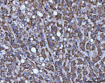 Anti-BBS9 Antibody