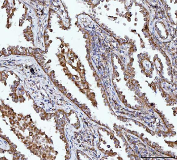 Anti-BBS9 Antibody