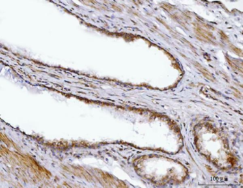 Anti-BBS9 Antibody