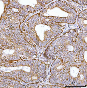 Anti-BBS9 Antibody