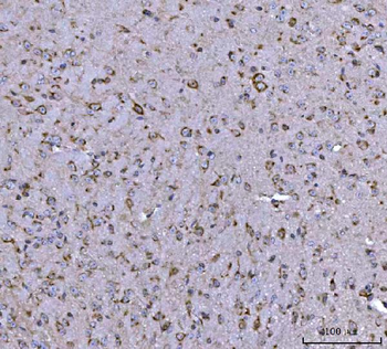 Anti-BBS9 Antibody