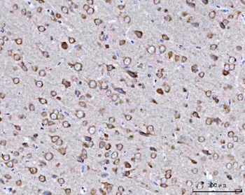 Anti-BBS9 Antibody