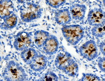 Anti-ATP4A Antibody