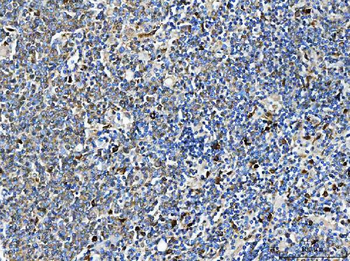 Anti-ARHGAP45 Antibody