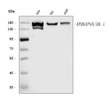 ARHGAP45 Antibody