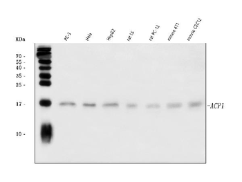 Acid phosphatase/ACP1 Rabbit Polyclonal Antibody