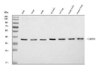 Anti-ABHD4 Antibody