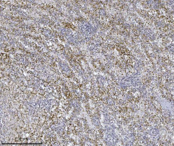 Integrin linked ILK Antibody (monoclonal, 3C7E1)
