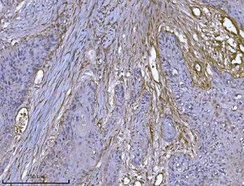 Anti-Integrin linked ILK Antibody (monoclonal, 3C7E1)