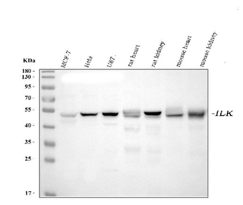 Anti-Integrin linked ILK Antibody (monoclonal, 3C7E1)