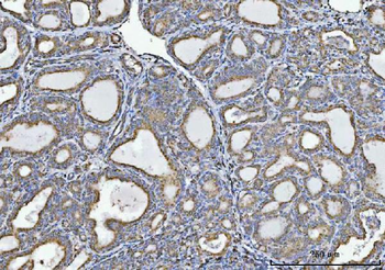 Anti-Glycine decarboxylase/GLDC Antibody (monoclonal, 3D3D3)