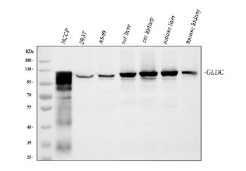 Anti-Glycine decarboxylase/GLDC Antibody (monoclonal, 3D3D3)