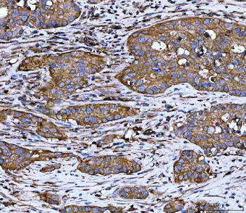 WDR1 Antibody (monoclonal, 5C11C8)