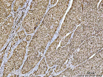 Anti-Ataxin 1 Antibody (monoclonal, 2B13G8)