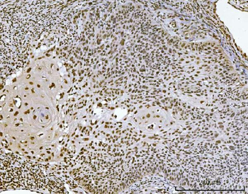 Anti-Ataxin 1 Antibody (monoclonal, 2B13G8)