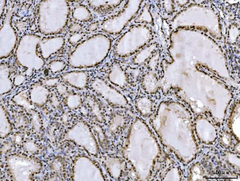 Anti-Ataxin 1 Antibody (monoclonal, 2B13G8)