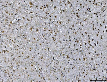 Anti-Ataxin 1 Antibody (monoclonal, 2B13G8)